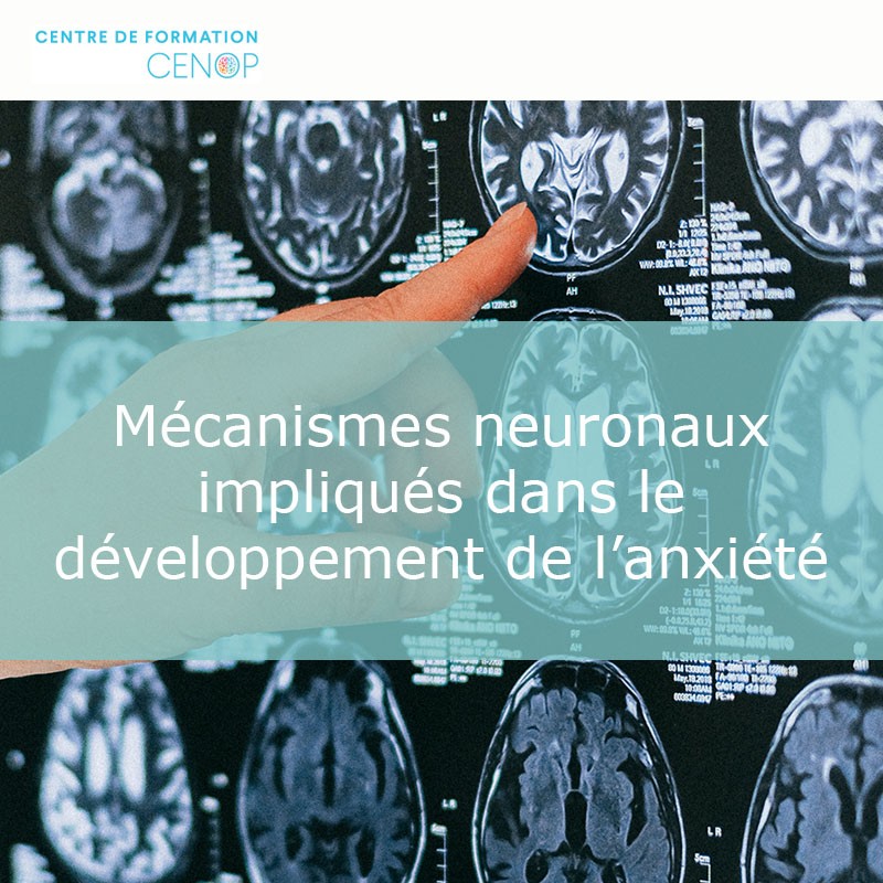 Mécanismes neuronaux impliqués dans le développement de l’anxiété